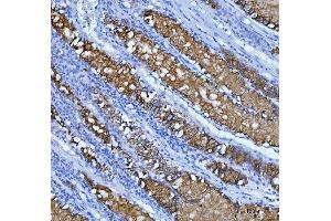 IHC analysis of Mucin-5AC using anti-Mucin-5AC antibody (ABIN3043460). (MUC5AC Antikörper  (AA 4848-5030))