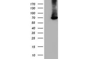 HEK293T cells were transfected with the pCMV6-ENTRY control (Left lane) or pCMV6-ENTRY EPM2AIP1 (Right lane) cDNA for 48 hrs and lysed. (EPM2AIP1 Antikörper)