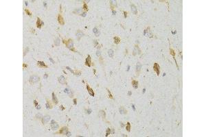 Immunohistochemistry of paraffin-embedded Rat brain using KISS1R Polyclonal Antibody at dilution of 1:100 (40x lens). (KISS1R Antikörper)