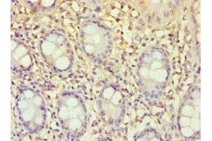Immunohistochemistry of paraffin-embedded human colon tissue using ABIN7151765 at dilution of 1:100 (ECE2 Antikörper  (AA 1-160))