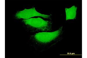 Immunofluorescence of monoclonal antibody to BAG1 on HeLa cell. (BAG1 Antikörper  (AA 241-345))