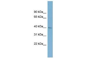 A4GALT antibody used at 1 ug/ml to detect target protein. (A4GALT Antikörper)