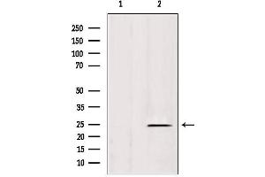 Western blot analysis of extracts from rat spleen, using IFT25 antibody.