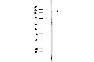 anti-Jumonji, AT Rich Interactive Domain 2 (JARID2) antibody