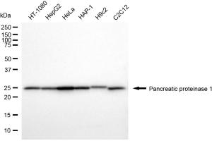 Western blotting analysis using pancreatic proteinase 1 antibody (ABIN7799732).