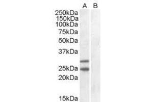 Image no. 2 for anti-Suppressor of Cytokine Signaling 1 (SOCS1) (C-Term) antibody (ABIN374072) (SOCS1 Antikörper  (C-Term))
