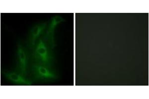Immunofluorescence analysis of HeLa cells, using Collagen IV alpha6 Antibody.