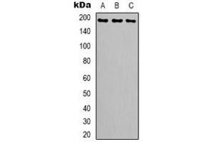 Western blot analysis of Topoisomerase 2 alpha expression in Hela (A), Jurkat (B), mouse brain (C) whole cell lysates. (Topoisomerase II alpha Antikörper  (C-Term))