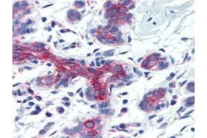 Human Breast (formalin-fixed, paraffin-embedded) stained with AIFM3at 5 µg/ml followed by biotinylated goat anti-rabbit IgG secondary antibody, alkaline phosphatase-streptavidin and chromogen. (AIFM3 Antikörper  (Center))