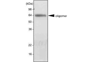 Western blot analysis of mouse liver extract was resolved by SDS - PAGE , transferred to PVDF membrane and probed with ADIPOQ monoclonal antibody , clone 5H7 (1 : 2000)  . (ADIPOQ Antikörper  (AA 15-244))