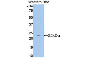 Western Blotting (WB) image for anti-Bleomycin Hydrolase (BLMH) (AA 30-165) antibody (ABIN3201698) (BLMH Antikörper  (AA 30-165))