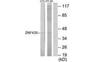 Western Blotting (WB) image for anti-Zinc Finger and SCAN Domain Containing 16 (ZSCAN16) (AA 191-240) antibody (ABIN2889761) (ZSCAN16 Antikörper  (AA 191-240))