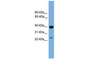 Image no. 1 for anti-Suppressor of Cytokine Signaling 1 (SOCS1) (AA 107-156) antibody (ABIN6744715) (SOCS1 Antikörper  (AA 107-156))