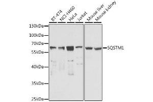Western blot analysis of extracts of various cell lines, using SQSTM1 antibody. (SQSTM1 Antikörper  (AA 1-440))