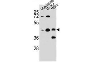 Western blot analysis of hCG_1645727 Antibody (C-term) in MDA-MB453,ZR-75-1,MCF-7 cell line lysates (35ug/lane). (KBTBD13 Antikörper  (C-Term))