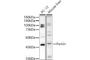 Western blot analysis of extracts of various cell lines, using Parkin antibody  at 1:500 dilution.