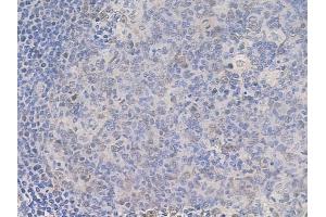 ABIN6261631 and ABIN6268696 at 1/100 staining human normal tonsil tissue by IHC-P. (EZH2 Antikörper  (Internal Region))