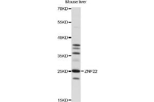 Western blot analysis of extracts of mouse liver, using ZNF22 antibody (ABIN6291375) at 1:1000 dilution. (Zinc Finger Protein 22 Antikörper)