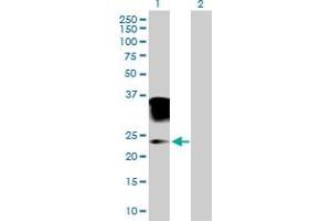 Western Blot analysis of ORM2 expression in transfected 293T cell line by ORM2 MaxPab polyclonal antibody. (Orosomucoid 2 Antikörper  (AA 1-201))