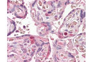 Anti-FANCE antibody IHC of human placenta. (FANCE Antikörper  (AA 235-247))