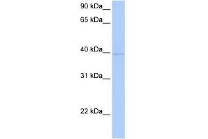 WB Suggested Anti-ZNF385D Antibody Titration:  0. (ZNF385D Antikörper  (C-Term))