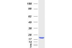 Validation with Western Blot