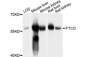 Western blot analysis of extracts of various cell lines, using FTCD antibody.