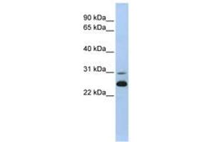 Image no. 1 for anti-Adenylate Kinase 1 (AK1) (AA 36-85) antibody (ABIN6741020) (Adenylate Kinase 1 Antikörper  (AA 36-85))