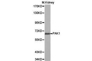 Western Blotting (WB) image for anti-P21-Activated Kinase 1 (PAK1) antibody (ABIN1874025) (PAK1 Antikörper)