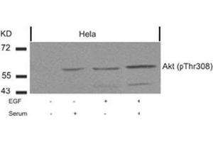 Image no. 2 for anti-V-Akt Murine Thymoma Viral Oncogene Homolog 1 (AKT1) (pThr308) antibody (ABIN196710) (AKT1 Antikörper  (pThr308))