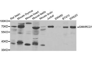 Western blot analysis of extracts of various cell lines, using SMARCD1 antibody (ABIN5973730) at 1/1000 dilution. (SMARCD1 Antikörper)