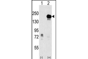 Western blot analysis of EHMT1 (arrow) using rabbit polyclonal EHMT1 Antibody (Center) (ABIN387856 and ABIN2844018). (EHMT1 Antikörper  (AA 367-396))