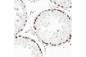 Immunohistochemistry (IHC) image for anti-Wilms Tumor 1 (WT1) antibody (ABIN7271368)