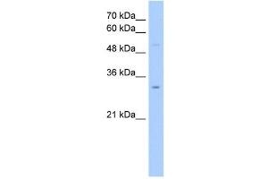 NSUN5C antibody used at 2. (NSUN5P2 Antikörper  (Middle Region))