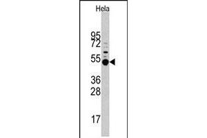 Western blot analysis of MAPKAPK5 polyclonal antibody  in HeLa cell line lysates (35 ug/lane). (MAPKAP Kinase 5 Antikörper  (Thr182))