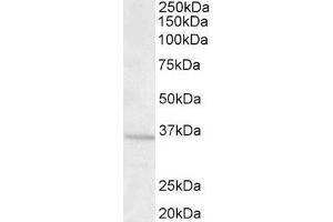 Western Blotting (WB) image for anti-Guanine Nucleotide Binding Protein (G Protein), beta Polypeptide 3 (GNB3) (Internal Region) antibody (ABIN185602)
