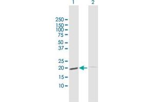 Western Blot analysis of ESM1 expression in transfected 293T cell line by ESM1 MaxPab polyclonal antibody. (ESM1 Antikörper  (AA 1-184))