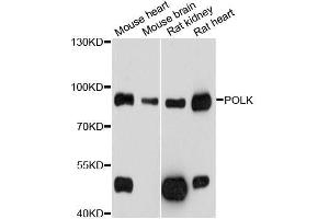 Western blot analysis of extracts of various cell lines, using POLK antibody (ABIN5998558) at 1/1000 dilution.