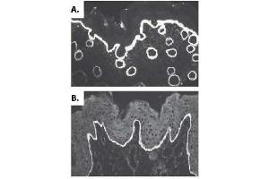 Image no. 2 for anti-Collagen, Type VII, alpha 1 (COL7A1) (AA 479-578), (AA 757-967), (AA 97-200) antibody (ABIN191494)