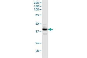 Western Blotting (WB) image for anti-UDP-Gal:betaGlcNAc beta 1,4- Galactosyltransferase, Polypeptide 3 (B4GALT3) (AA 1-393) antibody (ABIN948724)
