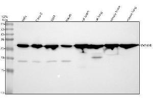 Western blot analysis of YWHAB using anti-YWHAB antibody (ABIN7603843).