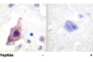 Immunohistochemical analysis of paraffin-embedded human brain tissue using CDC25B polyclonal antibody . (CDC25B Antikörper)