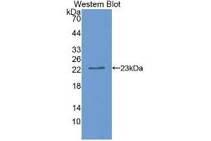 Detection of Recombinant CD27BP, Human using Polyclonal Antibody to CD27 Binding Protein (CD27BP) (SIVA1 Antikörper  (AA 1-175))