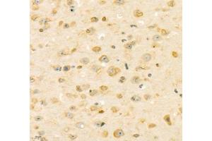 Immunohistochemistry (Paraffin-embedded Sections) (IHC (p)) image for anti-Adenosine Kinase (ADK) antibody (ABIN7072953)