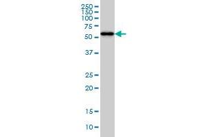 CPNE1 monoclonal antibody (M01), clone 8B8 Western Blot analysis of CPNE1 expression in HeLa .