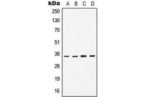 Western blot analysis of CD1b expression in H1299 (A), Jurkat (B), Raw264. (CD1b Antikörper  (Center))