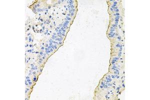 Immunohistochemistry of paraffin-embedded mouse lung using HPR antibody at dilution of 1:100 (x40 lens). (HPR Antikörper)