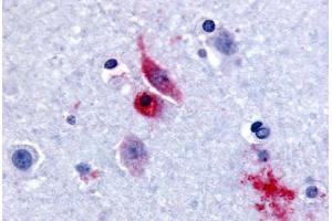 Human Brain, Caudate (formalin-fixed, paraffin-embedded) stained with GPR61 antibody ABIN213520 at 15-30 ug/ml followed by biotinylated goat anti-rabbit IgG secondary antibody ABIN481713, alkaline phosphatase-streptavidin and chromogen. (GPR61 Antikörper  (Extracellular Domain))