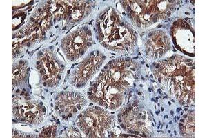 Image no. 6 for anti-V-Akt Murine Thymoma Viral Oncogene Homolog 1 (AKT1) antibody (ABIN1496557) (AKT1 Antikörper)