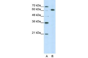 WB Suggested Anti-SNRP70 Antibody Titration:  5. (SNRNP70 Antikörper  (N-Term))